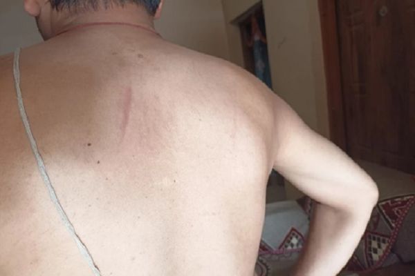 छत्तीसगढ़ में प्रभारी तहसीलदार के साथ पुलिस ने की मारपीट