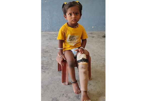 जयपुर पैर लगाकर खड़ा हुआ ढाई साल का दिसान